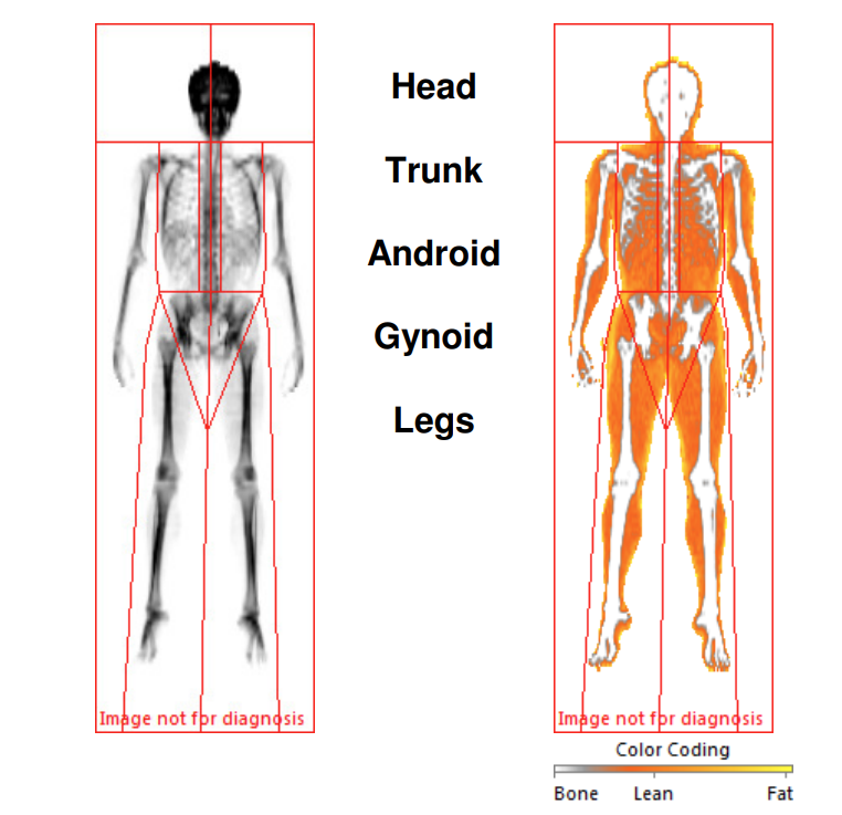 DEXA Scan